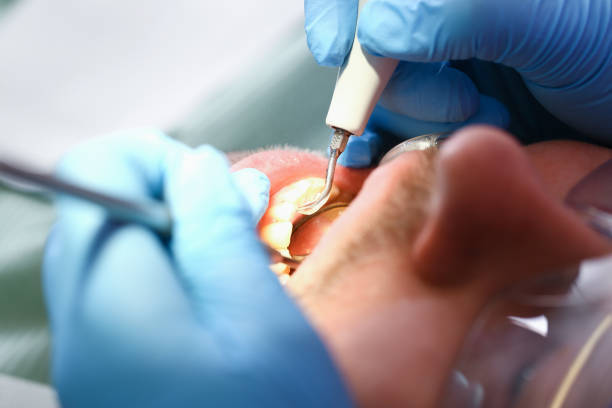 Best Emergency Broken Tooth Repair in Tatum, TX