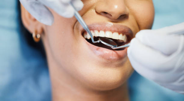 Best Same-Day Emergency Dentist in Tatum, TX