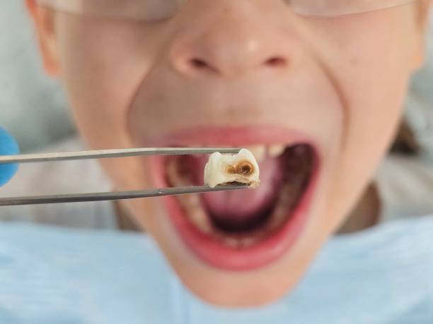 Best Weekend Emergency Dentist in Tatum, TX